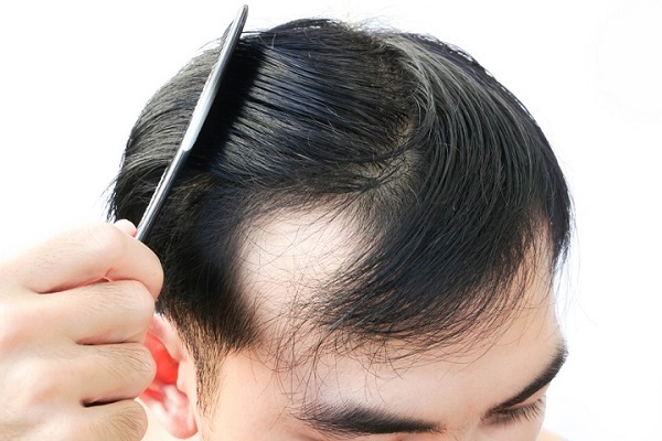 Vì sao cần chăm sóc tóc chuyên biệt cho nam và nữ  Sức khỏe