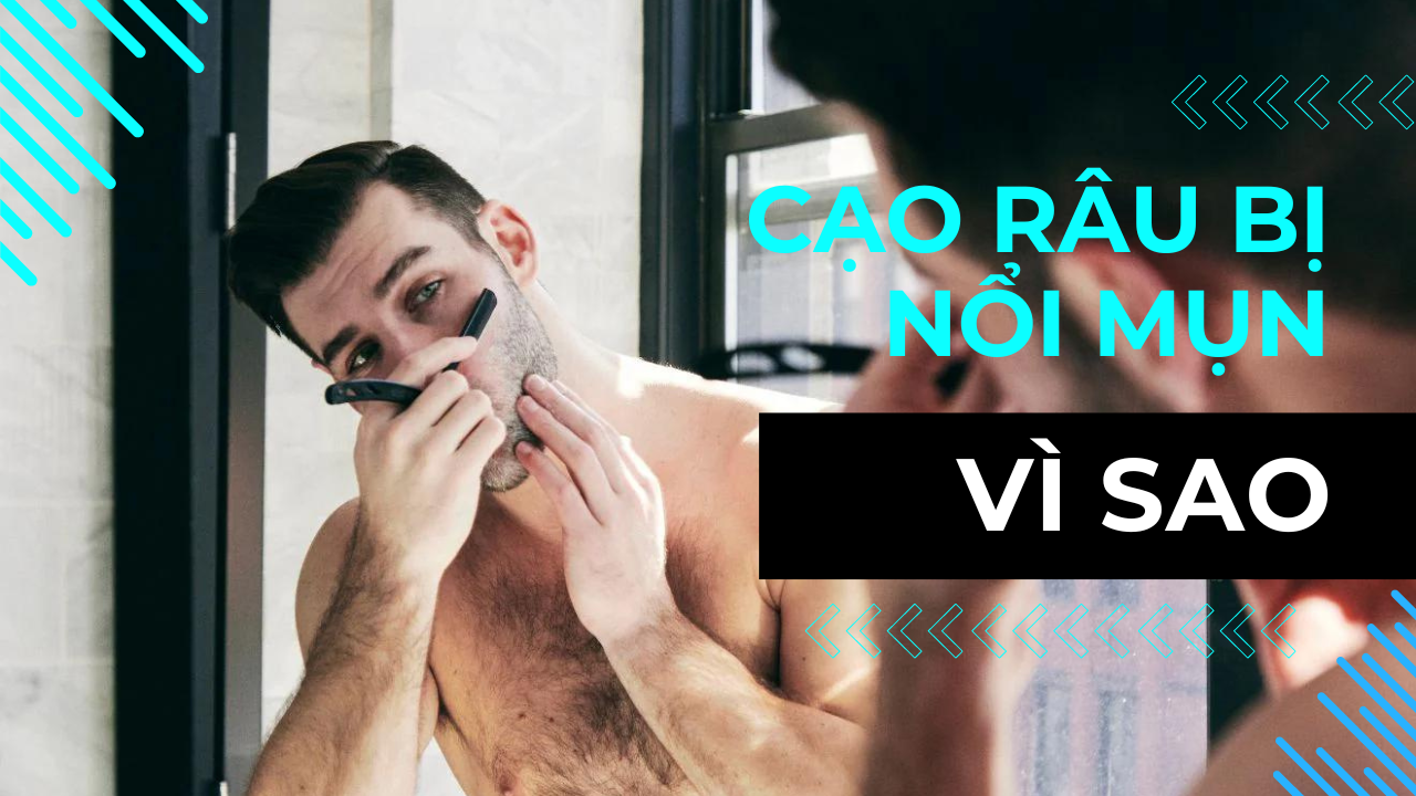 cạo râu bị nổi mụn