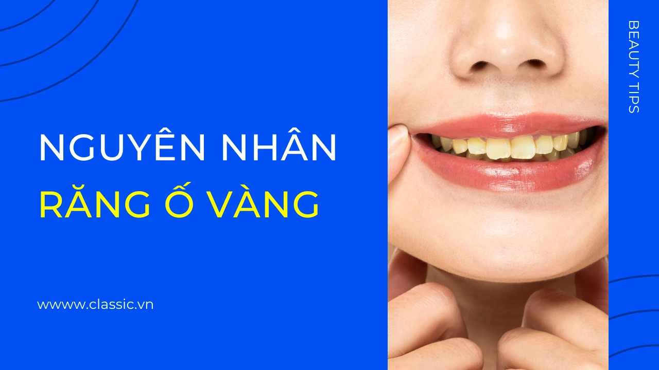 cách làm răng trắng khi bị ố vàng